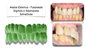 Dr Massimo Pedrinazzi - esempio di caso trattato