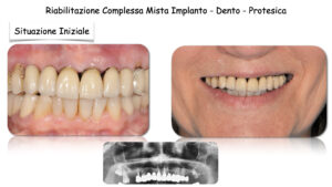 Dr Massimo Pedrinazzi - esempio di caso trattato