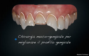 Dr Massimo Pedrinazzi - esempio di caso trattato