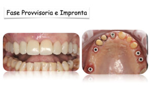 Dr Massimo Pedrinazzi - esempio di caso trattato